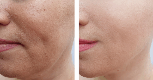 user-generated content in the form of before and after treatments for an aesthetic treatment